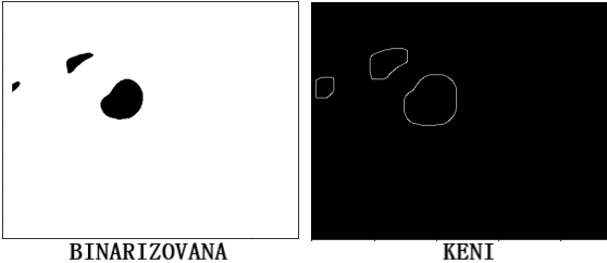 Slika 7 - slika pre i nakon primene Keni algoritma