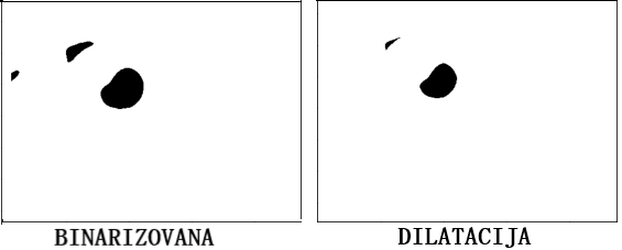 Slika 6 - Slika pre i nakon primene dilatacije