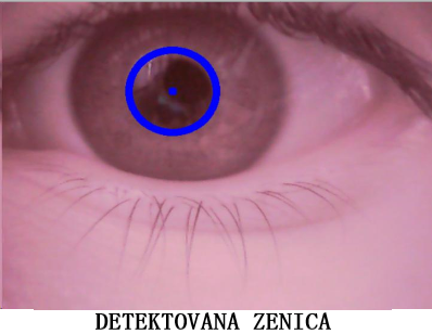 Slika 11 - Detektovana zenica
